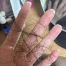 참소망약국 | 바르는 탈모약 미녹시딜 효과 부작용 남성 후기