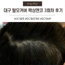 왁싱앤코 | 대구탈모 커버 탈모고민을 커버시켜준 대구왁싱앤코 3회차 후기