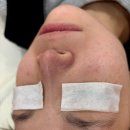 도곡약국 | 도곡역_ 아나토미 에스테틱 타워팰리스 도곡점 모공관리 솔직후기 / 강남역피부관리 / 강남에스테틱...