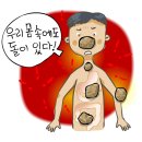 "눈 화장 너무 짙게 하지 마세요" 엄청난 통증 유발 ○ 위험 이미지