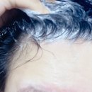 건성 | 바디브 미오 건성비듬샴푸 후기