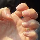 블리 | 광주네일 : 서리블리네일 이달의 네일 후기