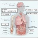 면역항암제 부작용 관리 - 부작용 없는 약은 없다. 이미지