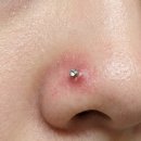 참한방병원 | 코 피어싱 후기 : 살튀에 염증 와도 힙한 건 힙함