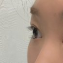 디어달