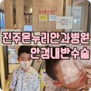 전주온누리안과병원 안검내반수술 솔직후기