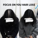 나는 소년이었다 SMP 이미지