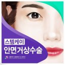 스템케이성형외과