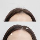 명지헤어라인 | 부산 강서구 명지눈썹왁싱 잘하는곳 후기｜모디모디에서 헤어라인왁싱받고 인상 완전 깔끔해짐
