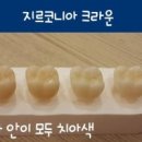 [비비안 치과] 치아색 크라운의 종류 이미지