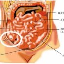 여자 맹장 위치 알아두면 맹장염 예방도 이미지