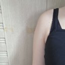 제로모텔1 | 신사 다이어트병원 팔뚝 슬림해진 찐후기 feat. 제로컷주사 2회차