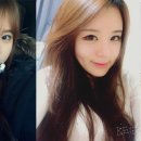 노블앤코성형외과 네이버블로그