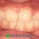 내이처럼치과병원 이미지