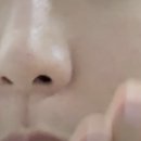 미라클케어 이미지