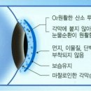 안경매니져 첨단산월점 네이버블로그
