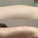 일산에스테틱 리본 에스테틱 일산점 등 에어바디 후기
