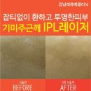 강남레쥬베의원 네이버블로그