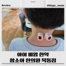 생생한의원 | 🌼아이 비염 치료 시작! 함소아 한의원 목동점 생생 후기🌼