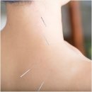 본디올신촌경희한의원 이미지