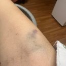 세븐일레븐 울산보람병원점 | 울산 보람병원 제왕절개 6박 7일 1인실 입원 후기