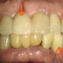 복음치과기공소 이미지