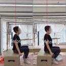 A.B.S밍광택 | 명일동 필라테스 통증 원인은 반드시 이유가 있습니다 | 체형교정 전문 필라테스 수업 B&A 후기