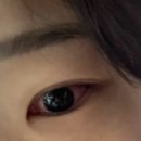 심청안과의원 네이버블로그