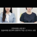 미다스한의원 | 안면비대칭 교정 후기｜얼굴비대칭 원인부터 변화까지 직접 느낀 미다스 교정