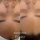 비앙리에 | 울산피부관리 물광윤곽 안티에이징 1회로도 효과 보장 비앙리에 에스테틱