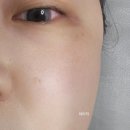 사상 엄궁 기미관리 잘하는 곳 이곳,뷰티샵 5일차 찐 후기