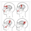 Temporalis (측두근) 이미지