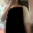 행복이열리는약국 | Review 04. 팔뚝 지방 추출 회복기｜밸런스 랩 아웃핏 수술 직후~한달 차 후기