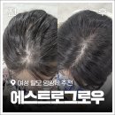 세이지약국 | 여성탈모 예방에 좋은 모발영양제로 추천하는 이유 (2주 후기)