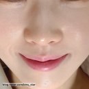 아누보스킨 이미지