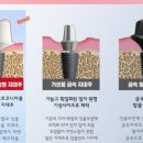 제니스치과기공소 이미지