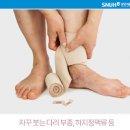 심부전 및 원인과 : 울혈성 심부전증 이미지