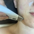 251-2-000025 | 원주피부관리: 리타임뷰티단계점, 트러블관리