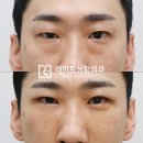 리미트성형외과의원 이미지