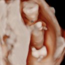 소향로 18 | [임신기록] 27주 3일 부천 서울여성병원 입체초음파, 임신성 당뇨 임당 재검 후기