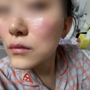 최강미룬이…쩝