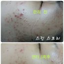 스킨스토리