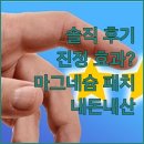아크로티 | 아크로티카 시카 마그네슘 패치, 정말 트러블 진정에 효과가 있을까? 솔직 후기!