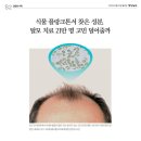인셀덤 드디어 신제품 출시 임박~!!