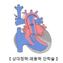 단 이미지