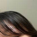 피플메디 | 메디쉴 두피앰플로 두피가려움과 각질 고민 싹 해결한 후기 (지루성 두피건선 추천)