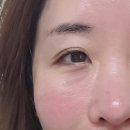 더나드 | NAD 주사 나드 수액 시술 후기! 비용 / 주기 / 효과 / 부작용 (ft. 강남 피부과)