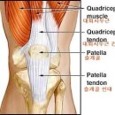 잘못된 스쿼트자세로 인한 무릎통증, 허리통증 이미지