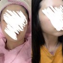 이끌림케어 | 구로구 고척동 피부관리 추천 | 이끌림 밸런스케어 올리지오 2000샷 후기