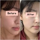 쌍문삼성 | 쌍문역 피부관리 로즈마리스킨케어 물광 완성 후기